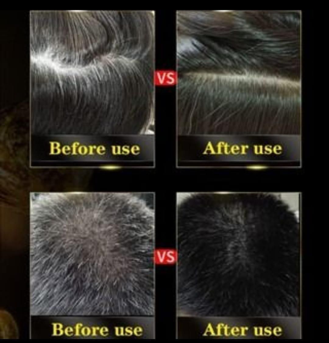 Black Hair Shampoo 3 in 1 (Pack of 2)